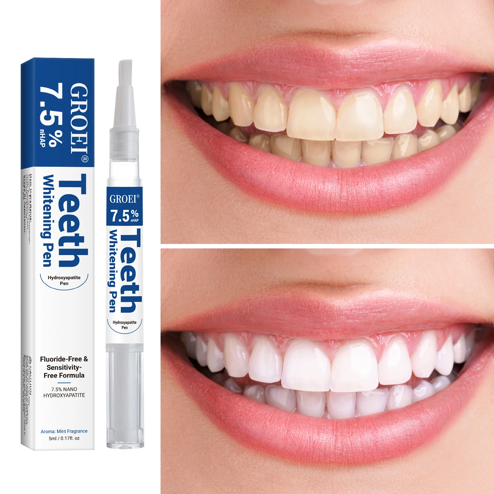 Гидроксипатитовая ручка для от – обзор и цена Teeth Whitening Ai
