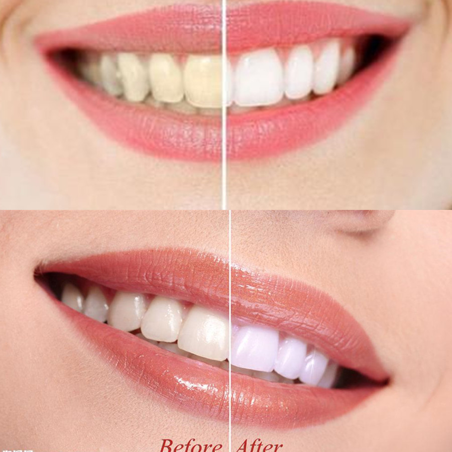 Бамбуковый уголь для зубов, ст – обзор и цена Teeth Paint Whitening
