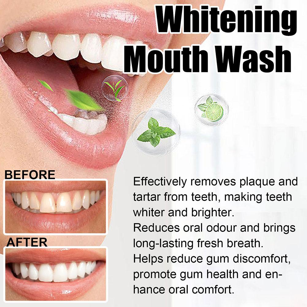 Кокосово-мятный ополаскиватель – обзор и цена Teeth Whitening Oil Pulling