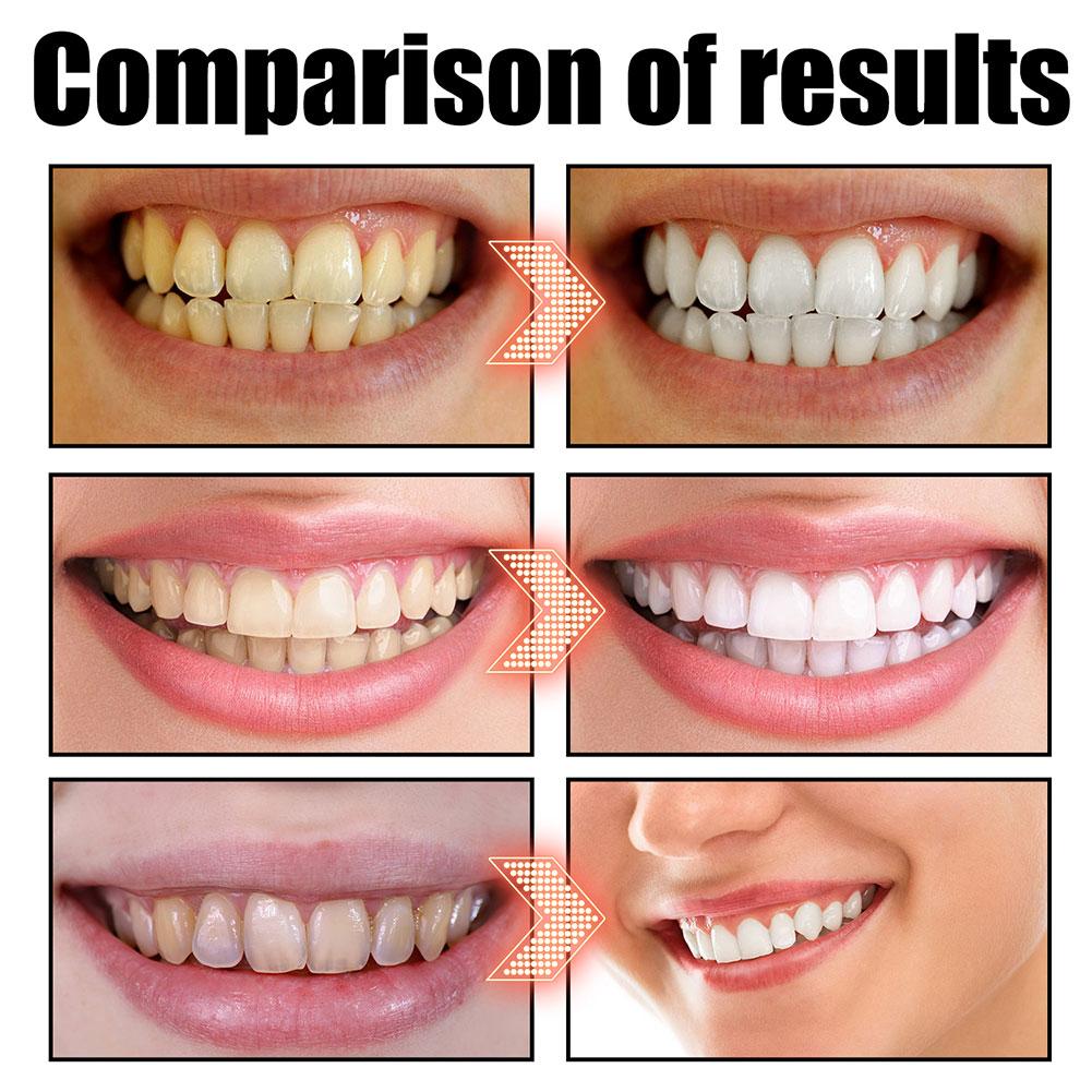 Кокосово-мятный ополаскиватель – обзор и цена Teeth Whitening Oil Pulling