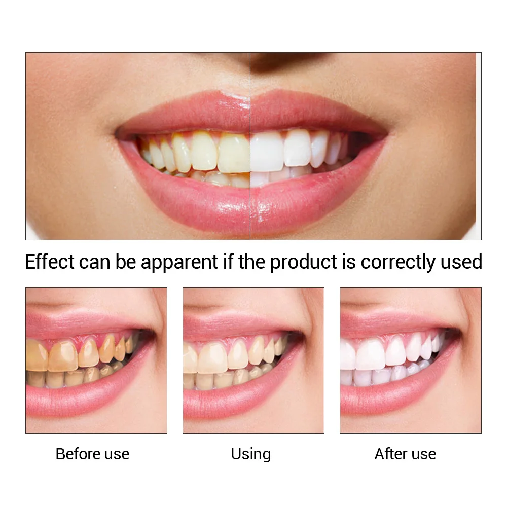 FTEENPLY отбеливание зубов быс – обзор и цена Teeth Paint Whitening