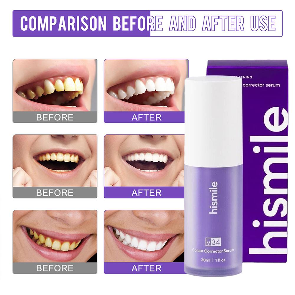 Зубная паста Hismile Purple дл – обзор и цена Teeth Paint Whitening