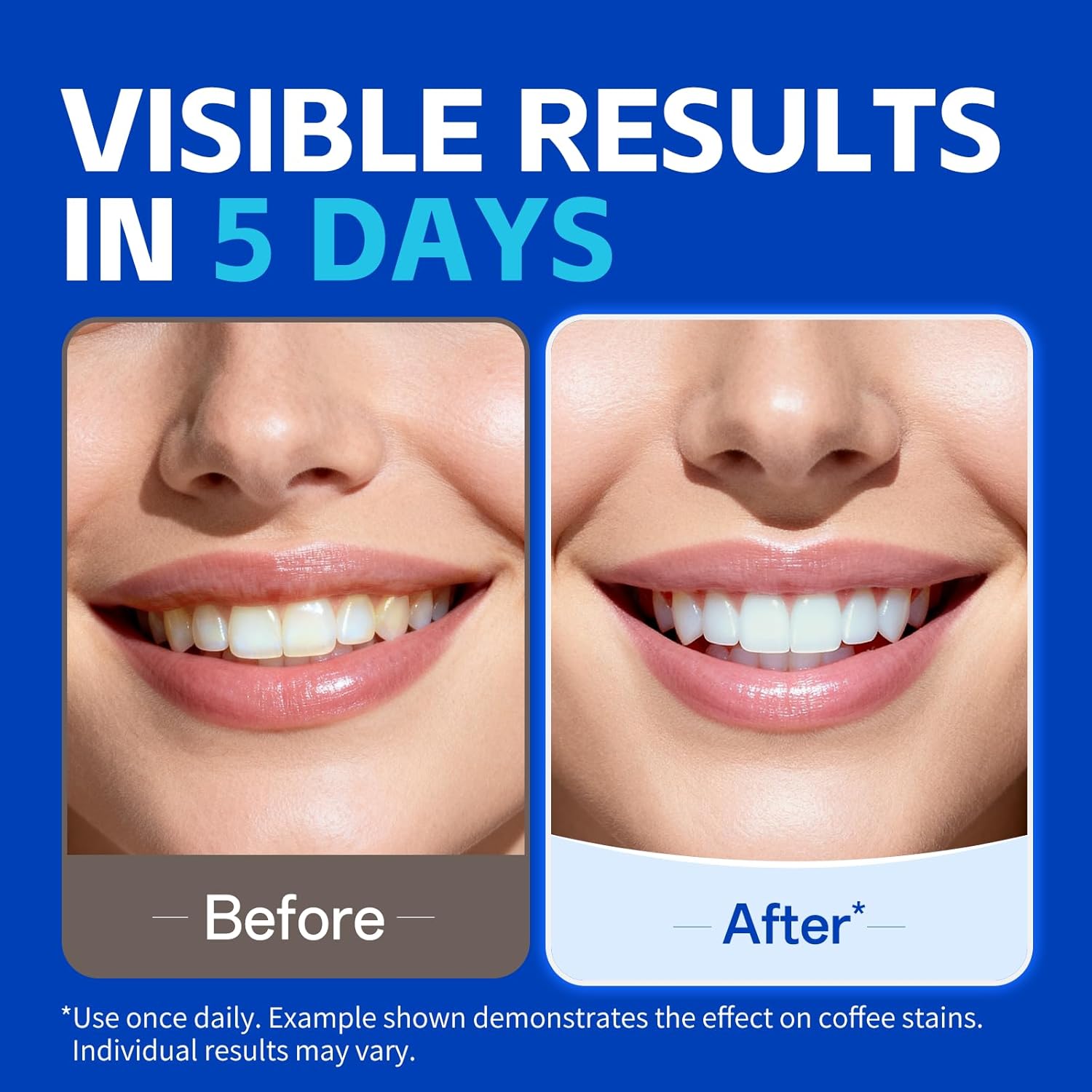 Отбеливающие полоски для зубов – обзор и цена Teeth Whitening Oil Pulling